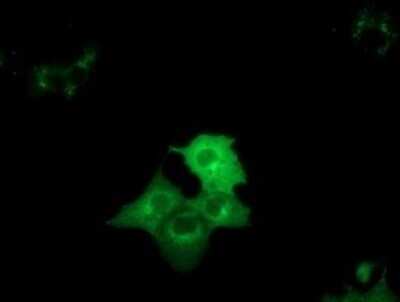 Immunofluorescence: DYNC1LI1 Antibody (OTI2E8) [NBP2-45682]