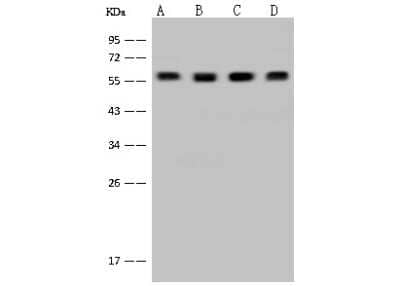 Western Blot: DYNC1LI1 Antibody [NBP2-97545]