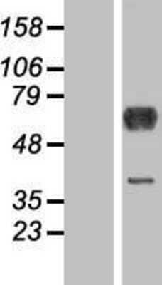 Western Blot: DYNC1LI1 Overexpression Lysate [NBP2-07086]