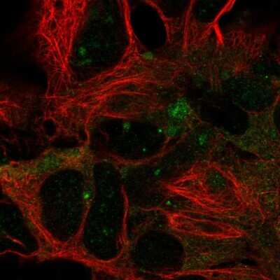 Immunocytochemistry/ Immunofluorescence: DYNC1LI2 Antibody [NBP2-58088]