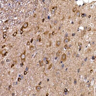 Immunohistochemistry-Paraffin: DYNC1LI2 Antibody - Azide and BSA Free [NBP3-16056]