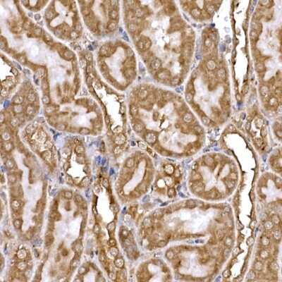 Immunohistochemistry-Paraffin: DYNC1LI2 Antibody - Azide and BSA Free [NBP3-16056]