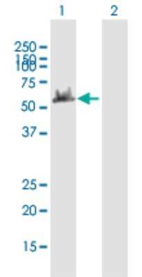 Western Blot: DYNC1LI2 Antibody [H00001783-B01P]