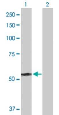 Western Blot: DYNC1LI2 Antibody [H00001783-D01P]