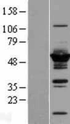 Western Blot: DYNC1LI2 Overexpression Lysate [NBL1-10068]