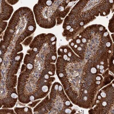 Immunohistochemistry-Paraffin: DYNC2H1 Antibody [NBP1-94086]