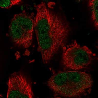Immunocytochemistry/ Immunofluorescence: DYNLT1 Antibody [NBP2-58497]