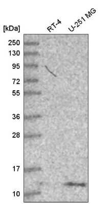 Western Blot: DYNLT1 Antibody [NBP2-58497]