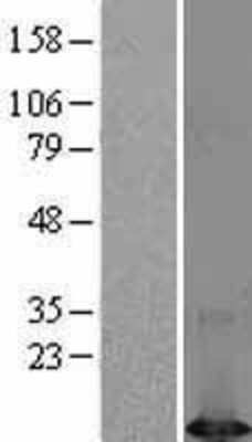 Western Blot: DYNLT1 Overexpression Lysate [NBL1-10073]