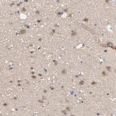 Immunohistochemistry-Paraffin: DYNLT3 Antibody [NBP1-80698]