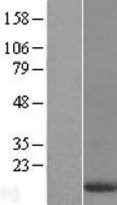 Western Blot: DYNLT3 Overexpression Lysate [NBL1-10074]