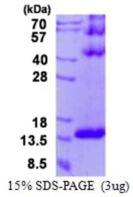 SDS-PAGE: Recombinant Human DYNLT3 His Protein [NBP2-23015]