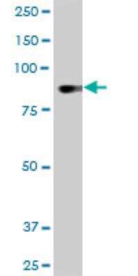 Western Blot: DYRK1A Antibody (7D10) [H00001859-M01]