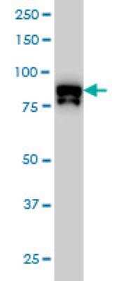 Western Blot: DYRK1A Antibody (7D10) [H00001859-M01]