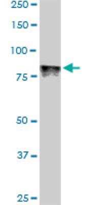 Western Blot: DYRK1A Antibody (7D10) [H00001859-M01]