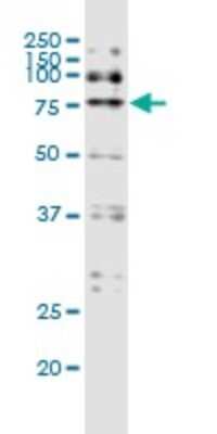 Western Blot: DYRK1A Antibody (7D10) [H00001859-M01]