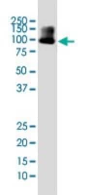 Western Blot: DYRK1A Antibody (7D10) [H00001859-M01]