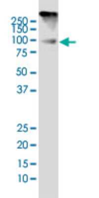 Western Blot: DYRK1A Antibody (7D10) [H00001859-M01]