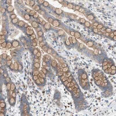Immunohistochemistry-Paraffin: DYRK1A Antibody [NBP1-84031]