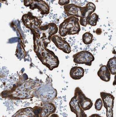 Immunohistochemistry-Paraffin: DYRK1A Antibody [NBP1-84032]