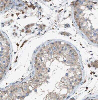 Immunohistochemistry-Paraffin: DYRK1A Antibody [NBP1-84032]