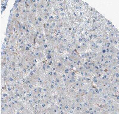 Immunohistochemistry-Paraffin: DYRK1A Antibody [NBP1-84032]