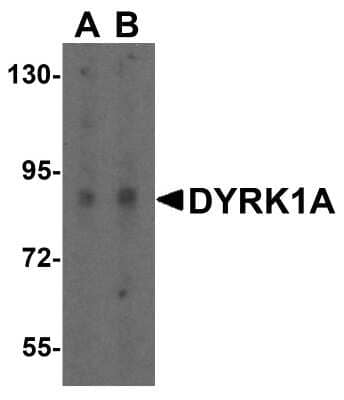 Western Blot: DYRK1A AntibodyBSA Free [NBP1-76559]