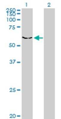 Western Blot: DYRK2 Antibody (3G5) [H00008445-M01]