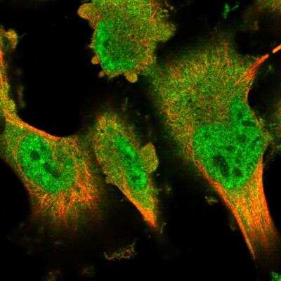 Immunocytochemistry/ Immunofluorescence: DYRK2 Antibody [NBP1-89516]