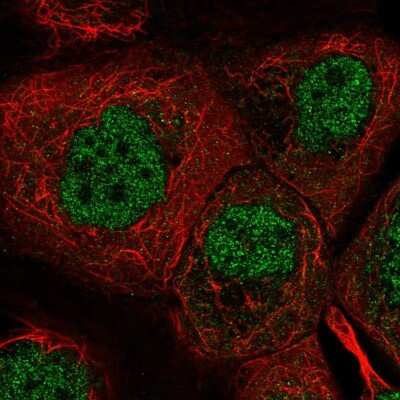 Immunocytochemistry/ Immunofluorescence: DYRK2 Antibody [NBP2-58747]