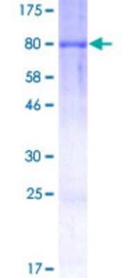 SDS-PAGE: Recombinant Human DYRK2 GST (N-Term) Protein [H00008445-P01]