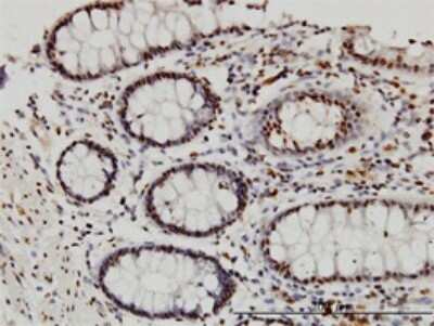 Immunohistochemistry-Paraffin: DYRK3 Antibody (3E10) [H00008444-M01]