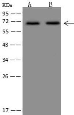 Western Blot: DYRK3 Antibody [NBP3-12695]