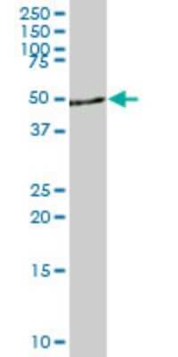 Western Blot: DYRK4 Antibody (3B9) [H00008798-M04]