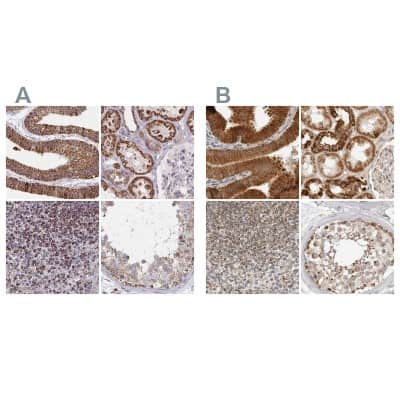 Immunohistochemistry-Paraffin: DYRK4 Antibody [NBP2-38781]