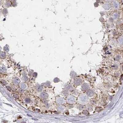 Immunohistochemistry-Paraffin: DYRK4 Antibody [NBP2-38781]