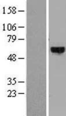 Western Blot: DYRK4 Overexpression Lysate [NBL1-10078]