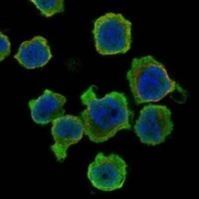 Immunocytochemistry/ Immunofluorescence: DYSFIP1 Antibody [NBP3-17243]