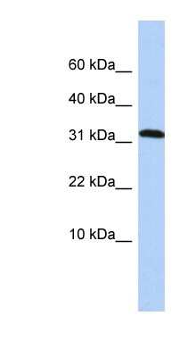 Western Blot: DYSFIP1 Antibody [NBP1-55525]