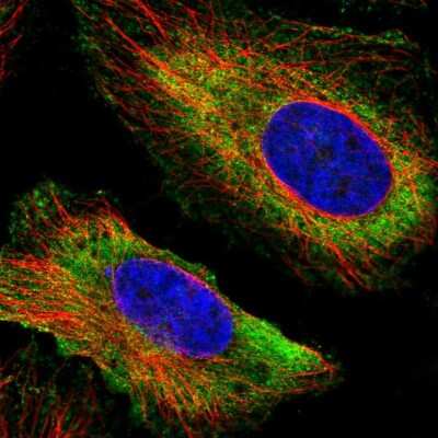 Immunocytochemistry/ Immunofluorescence: DYX1C1 Antibody [NBP2-47476]