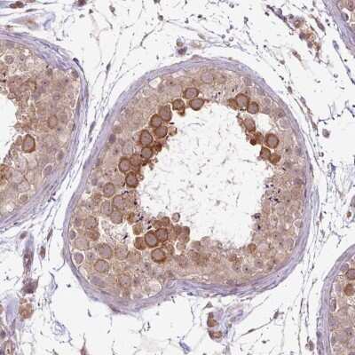 Immunohistochemistry-Paraffin: DYX1C1 Antibody [NBP2-47476]
