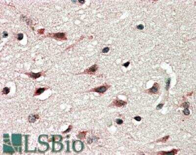 Immunohistochemistry-Paraffin: DYX1C1 Antibody [NBP1-68766]