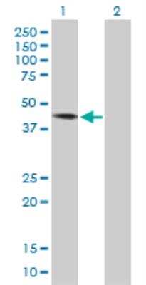 Western Blot: DYX1C1 Antibody [H00161582-D01P]