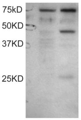 Western Blot: DYX1C1 Antibody [NBP1-68766]