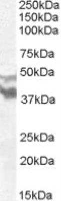 Western Blot: DYX1C1 Antibody [NBP1-68815]