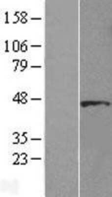 Western Blot: DYX1C1 Overexpression Lysate [NBL1-10080]