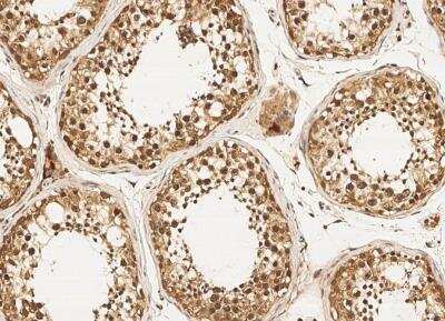 Immunohistochemistry-Paraffin: DZIP1 Antibody (05) [NBP3-05837]