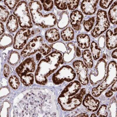 Immunohistochemistry: DZIP1 Antibody [NBP2-31587]