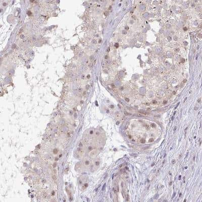 Immunohistochemistry-Paraffin: DZIP1 Antibody [NBP2-31669]