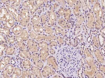 Immunohistochemistry-Paraffin: DZIP1 Antibody [NBP2-97402]